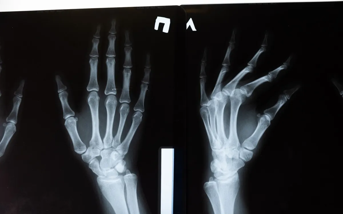 An orthopaedic surgeon reviewing an x-ray.